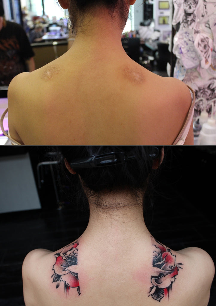 Tattoo Ink for Scars and Coverups: Choosing the Right Color for Your Design